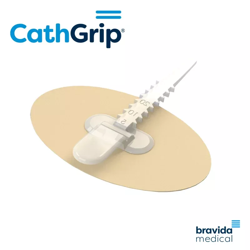 CathGrip Single Strap, Extra Small Non-Sterile, No Wipe